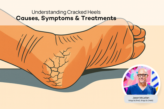 Cracked Heels - Podiatry Corner