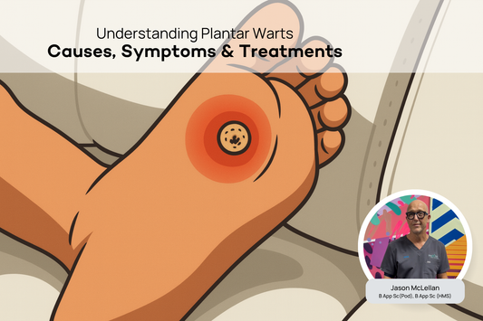 Plantar Warts - Podiatry Corner